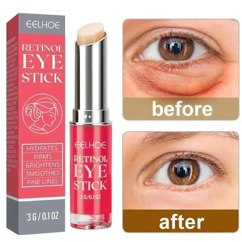 Anti Wrinkle Eye Cream